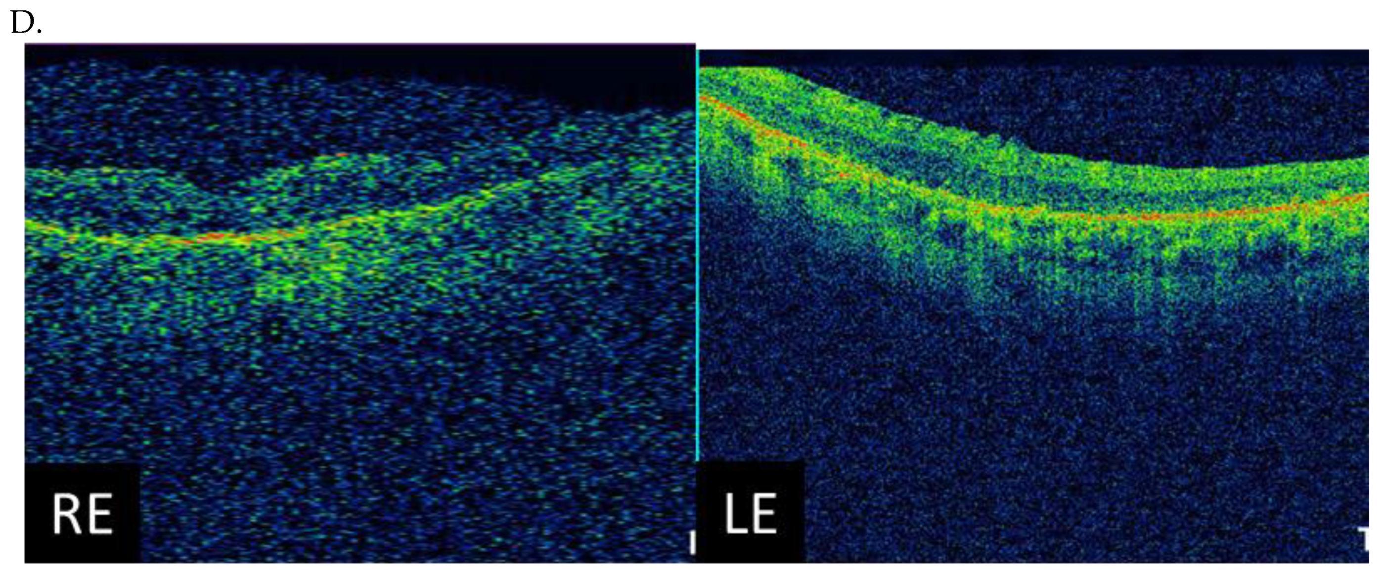 Genes 14 01950 g003b