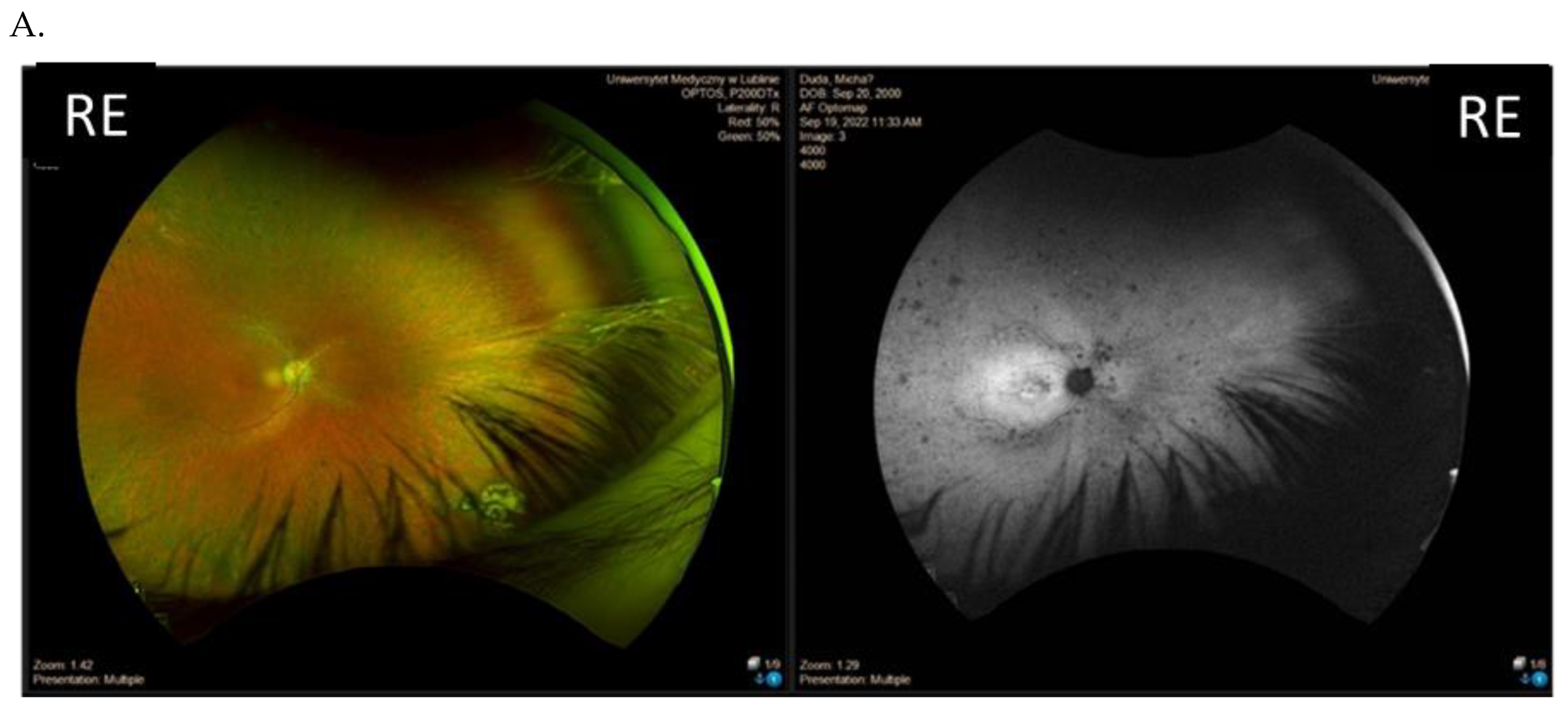 Genes 14 01950 g004a
