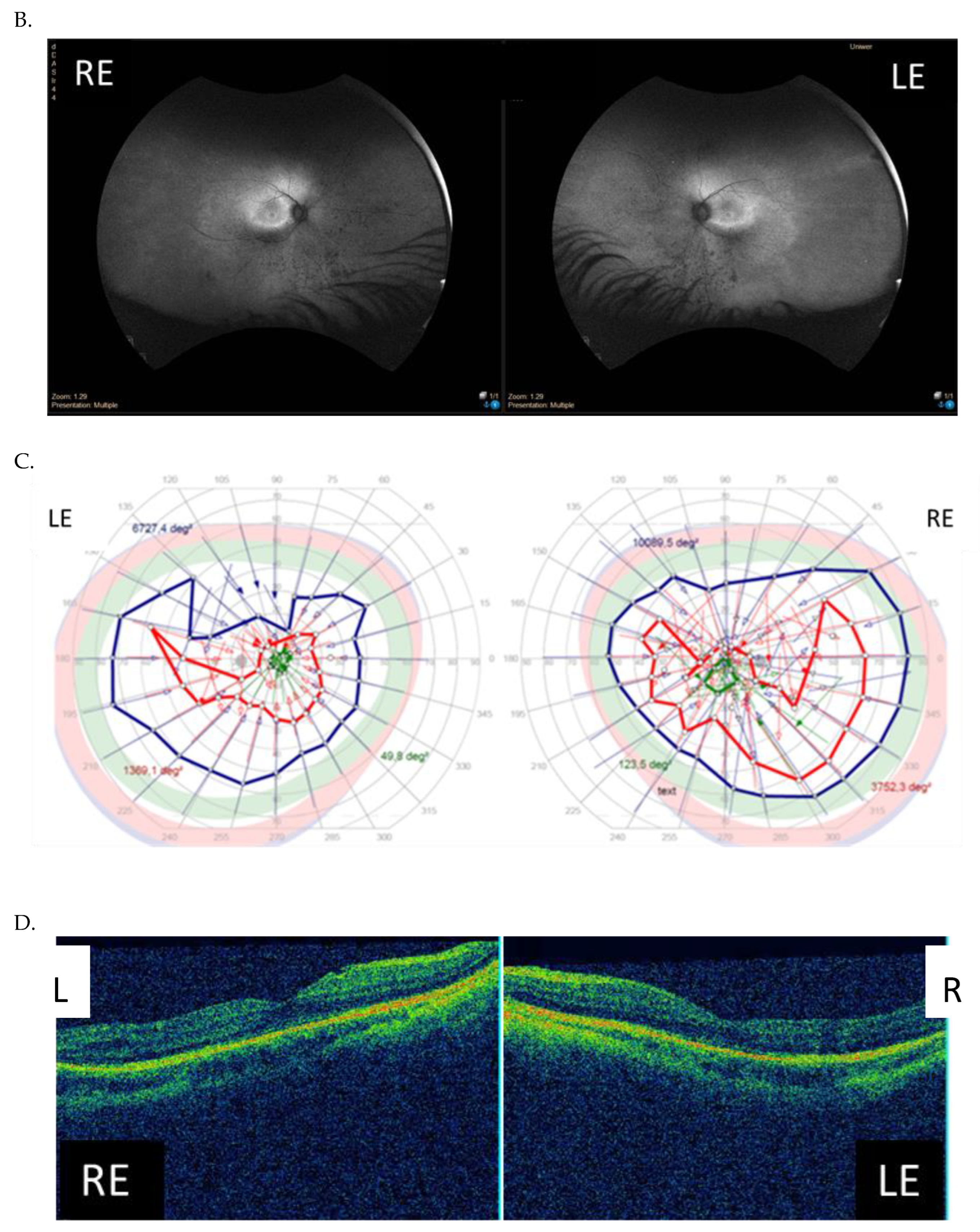 Genes 14 01950 g005b