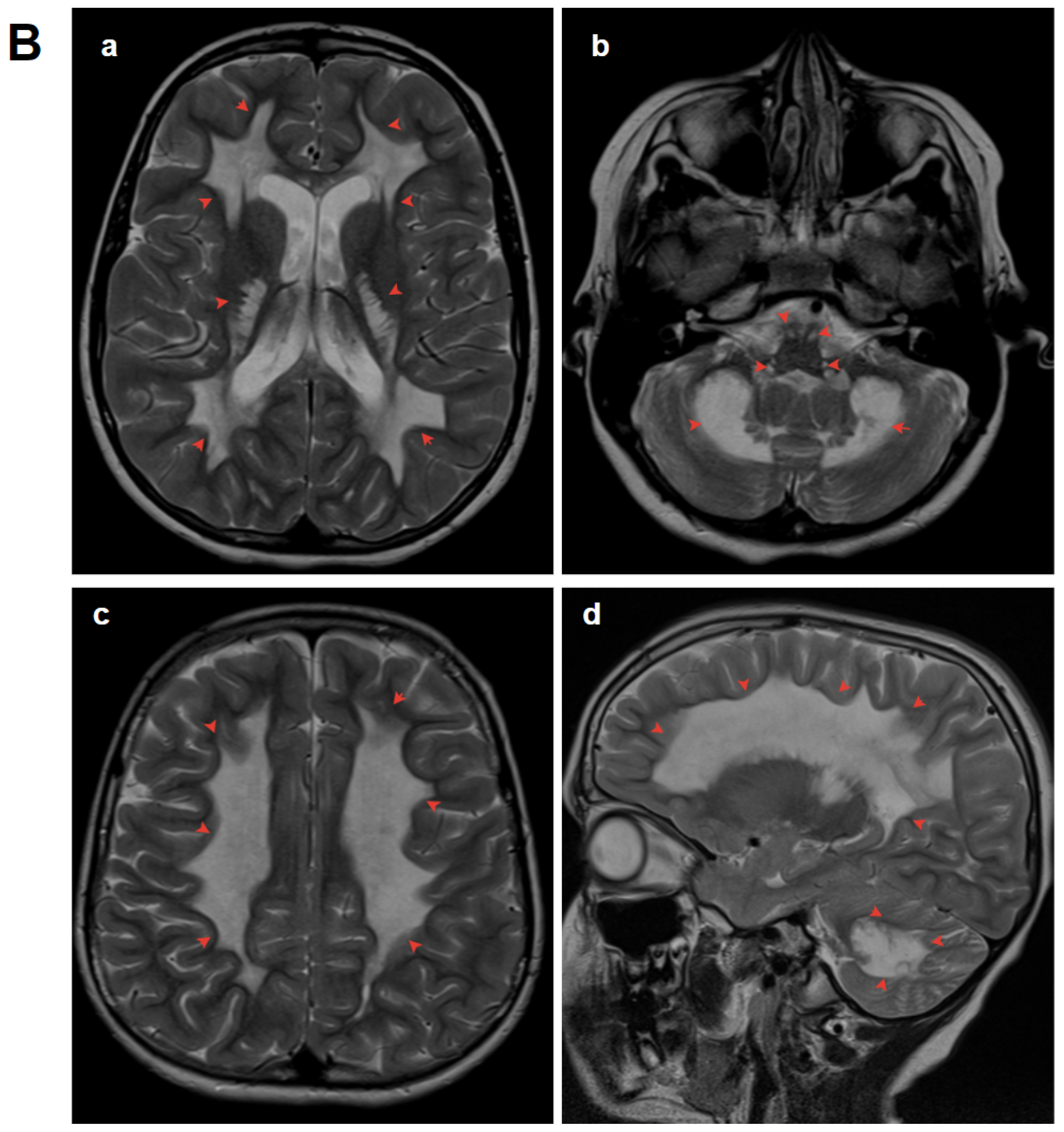 Genes 15 00615 g002b