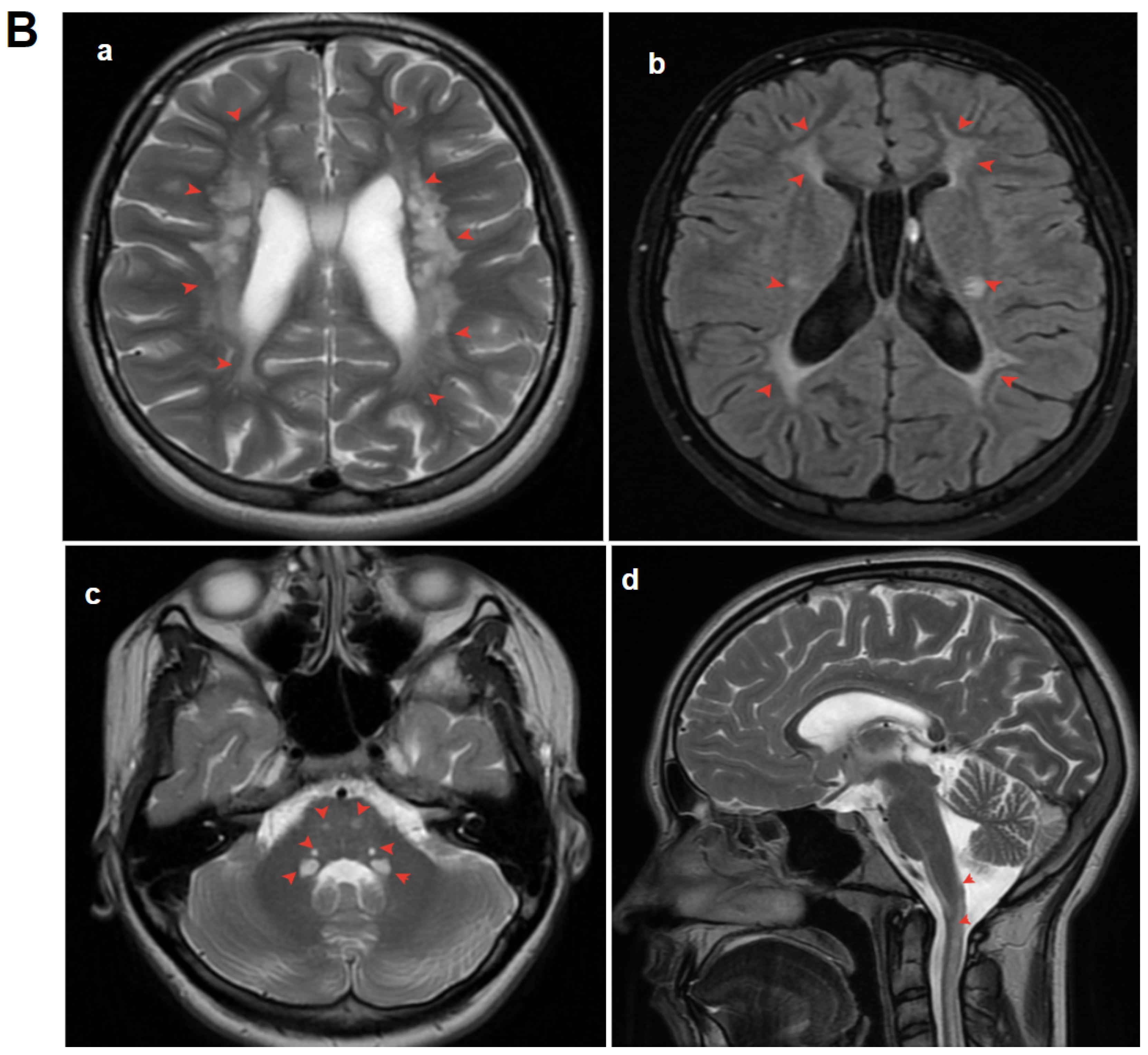 Genes 15 00615 g004b