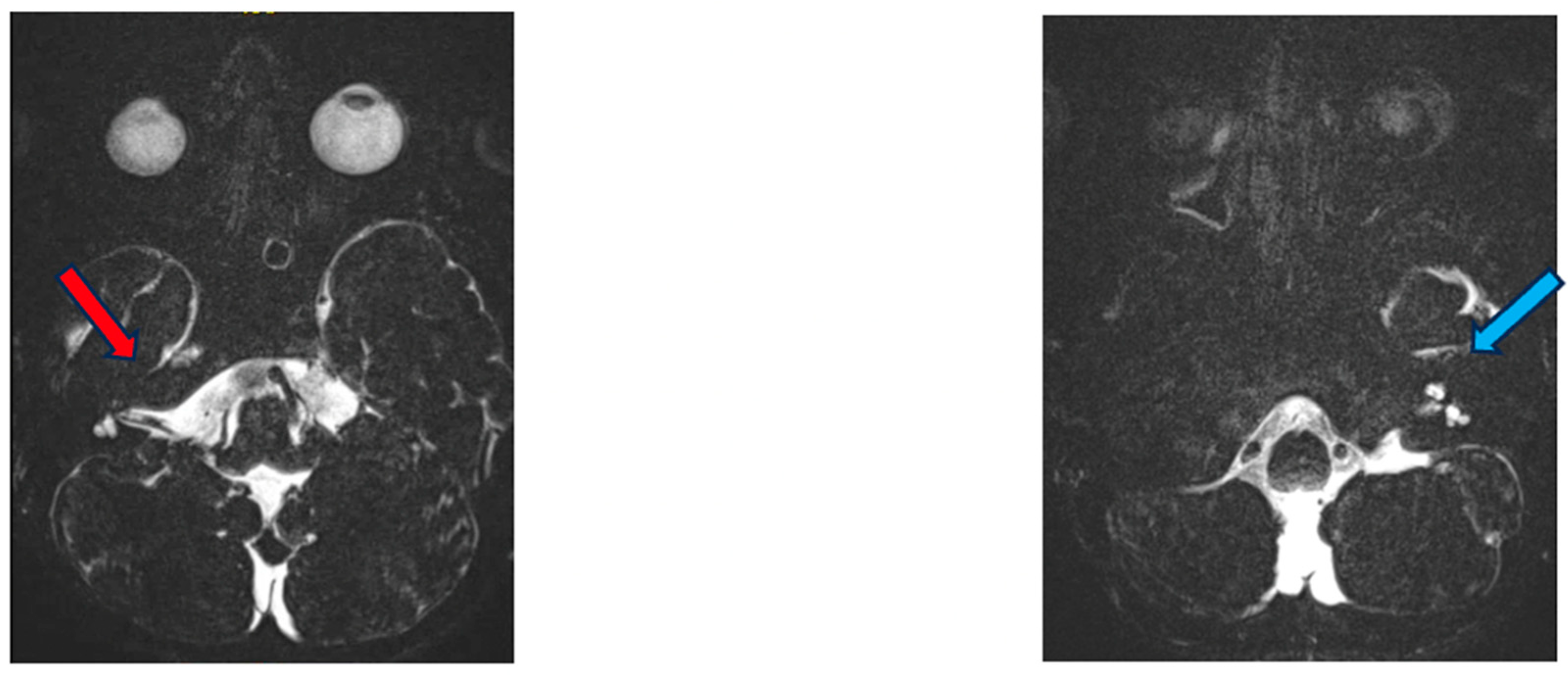 Genes 15 00643 g002 Genes 15 00643 g002
