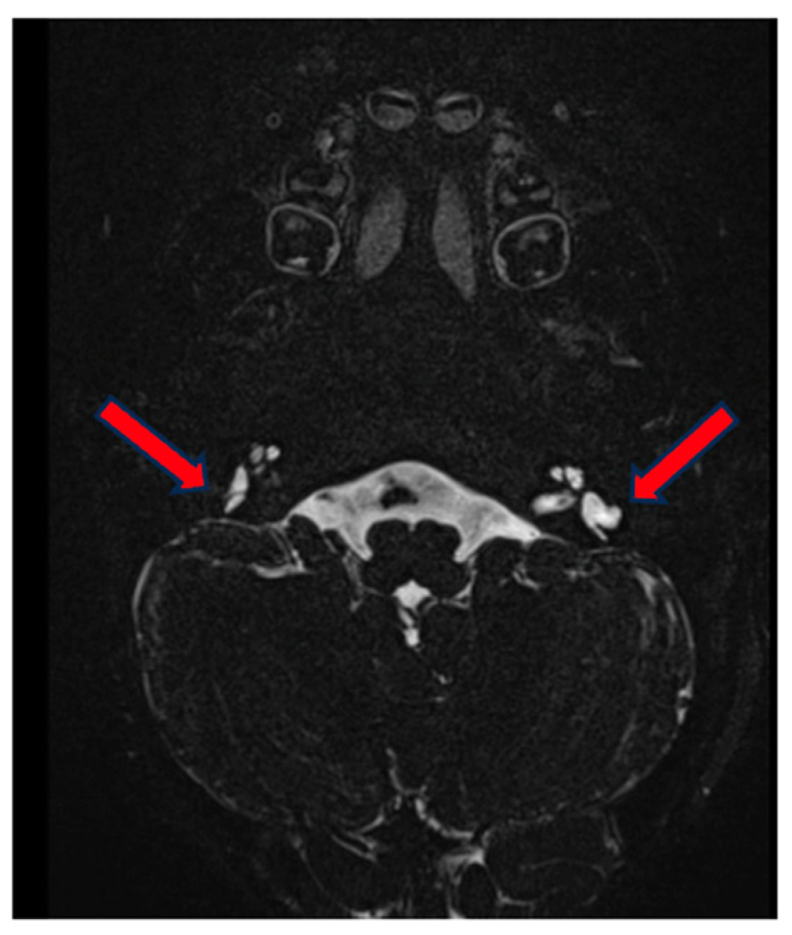 Genes 15 00643 g004 Genes 15 00643 g004