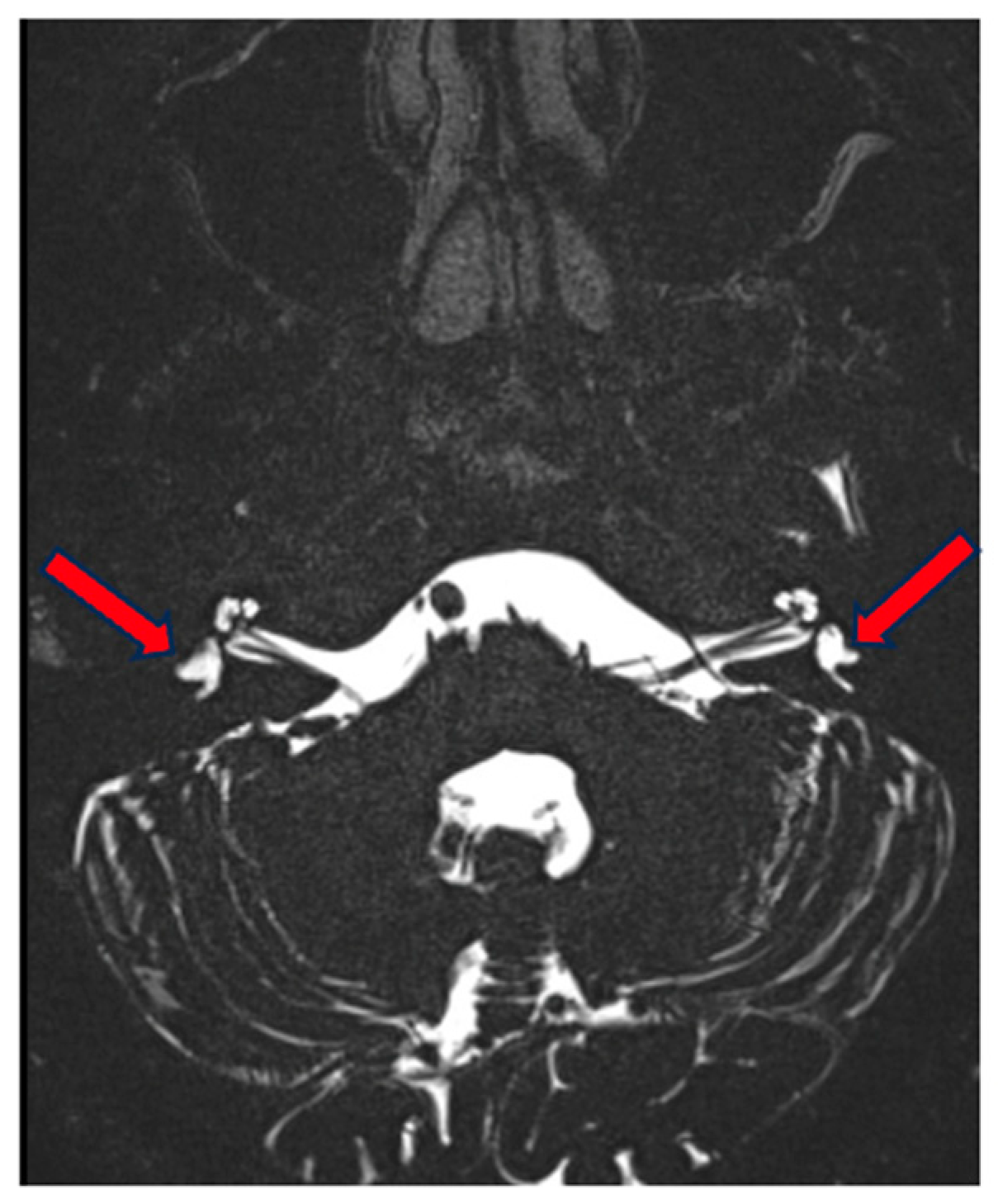 Genes 15 00643 g007 Genes 15 00643 g007