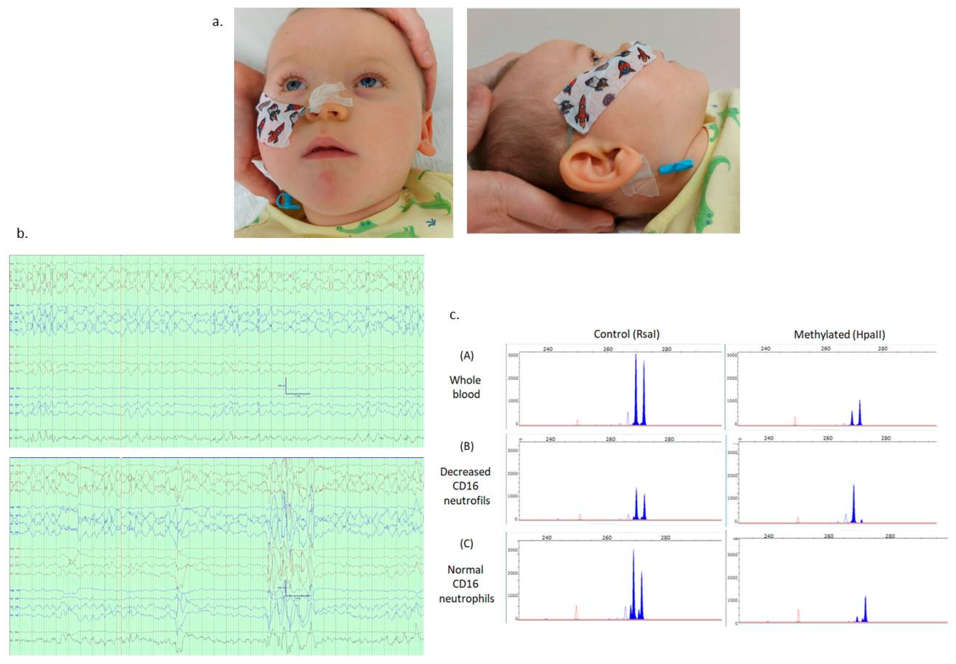 Genes 15 00802 g001 Genes 15 00802 g001
