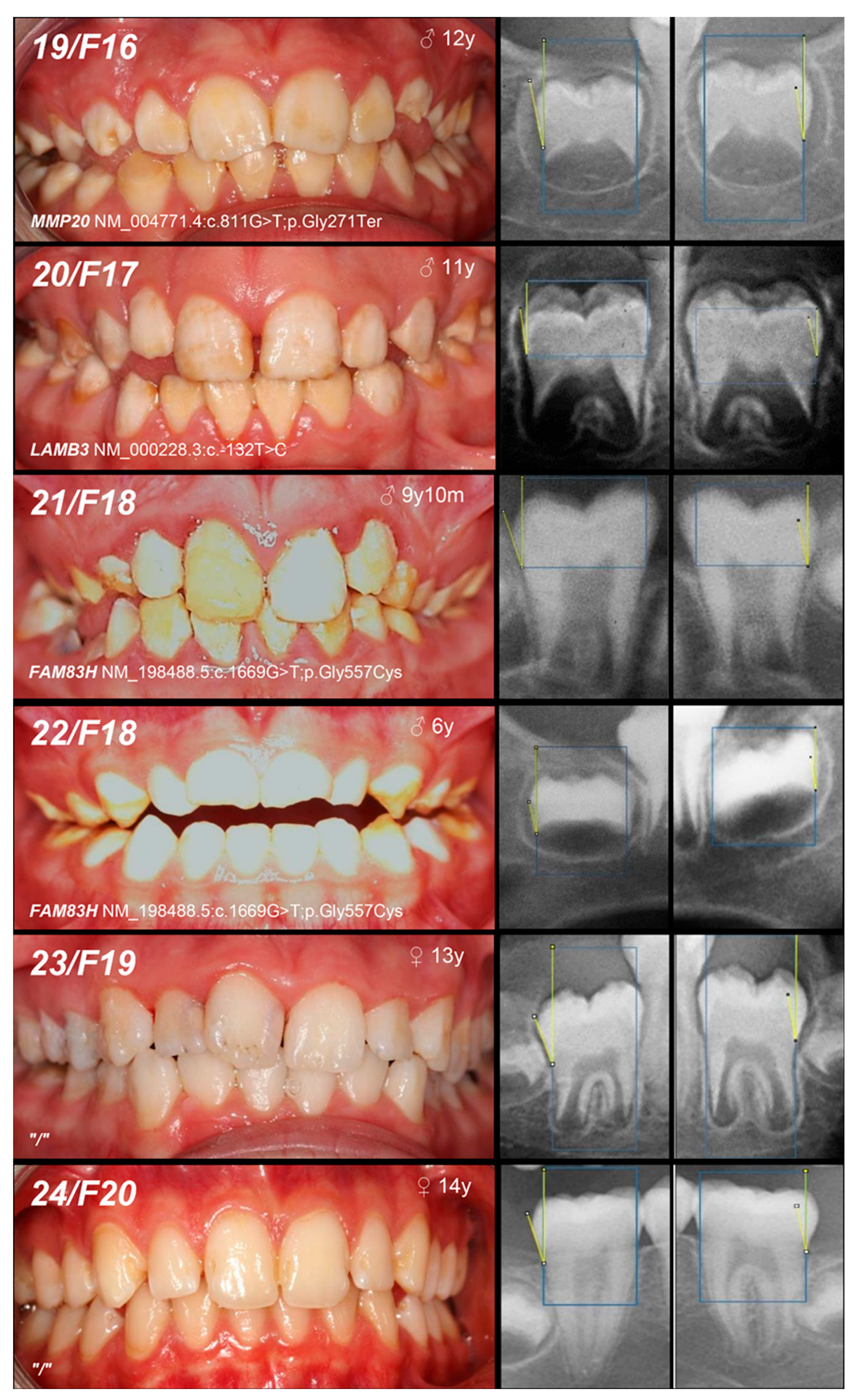 Genes 16 00822 g002d Genes 16 00822 g002d