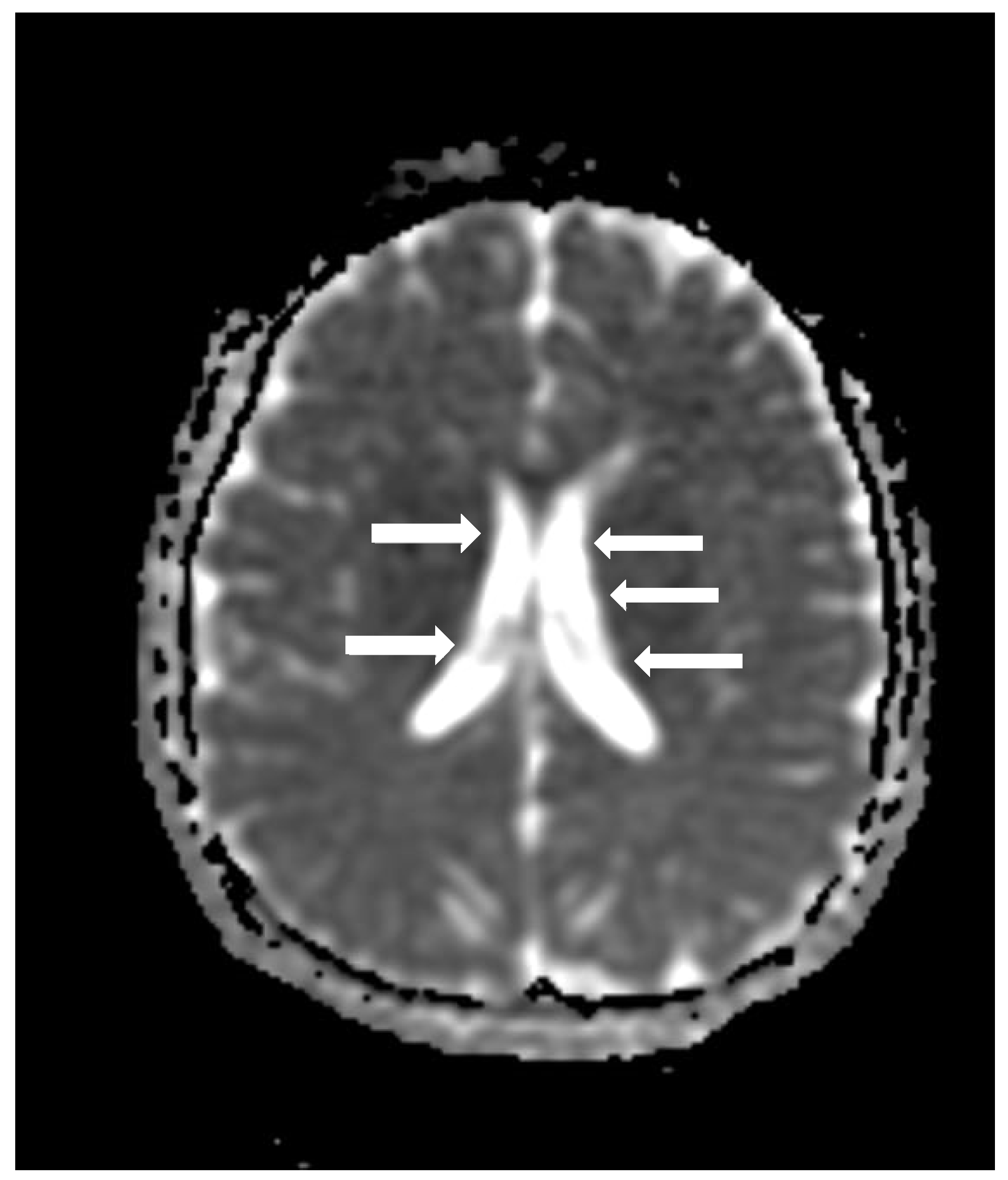 Genes 16 00870 g003b