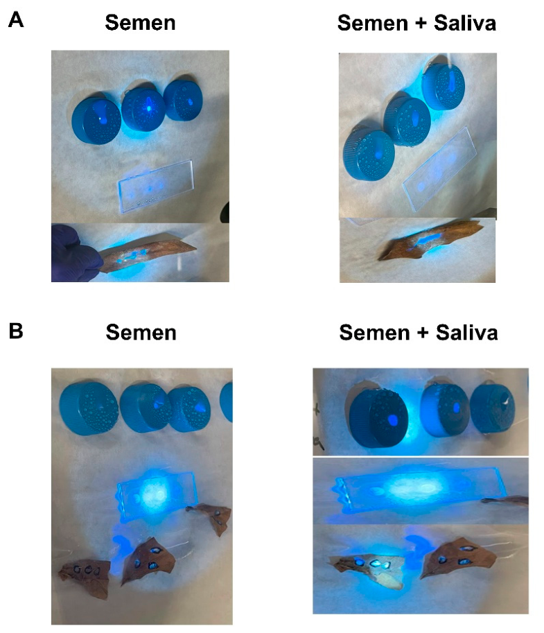 Genes 17 01269 g004 Genes 17 01269 g004