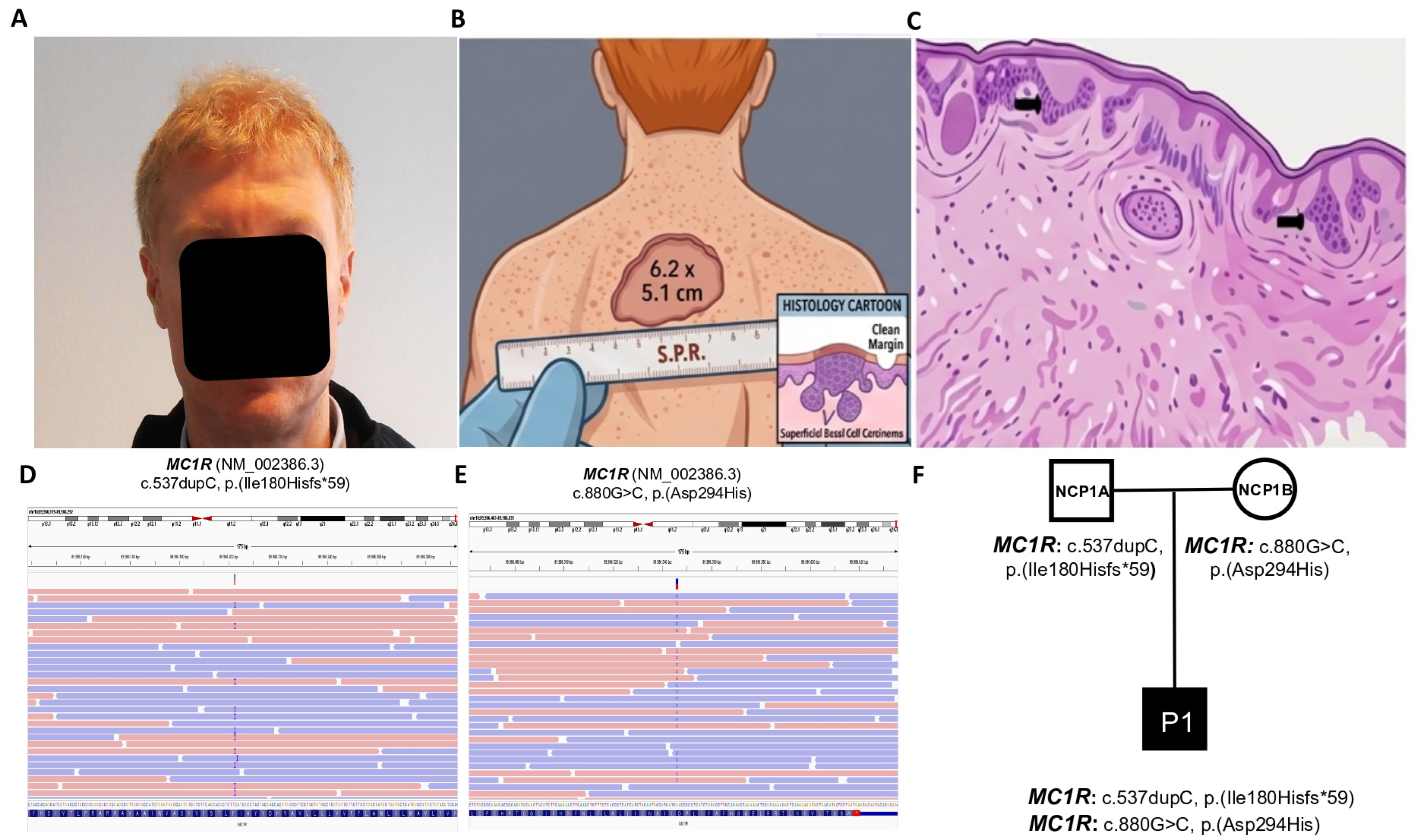 Genes 17 01289 g001 Genes 17 01289 g001