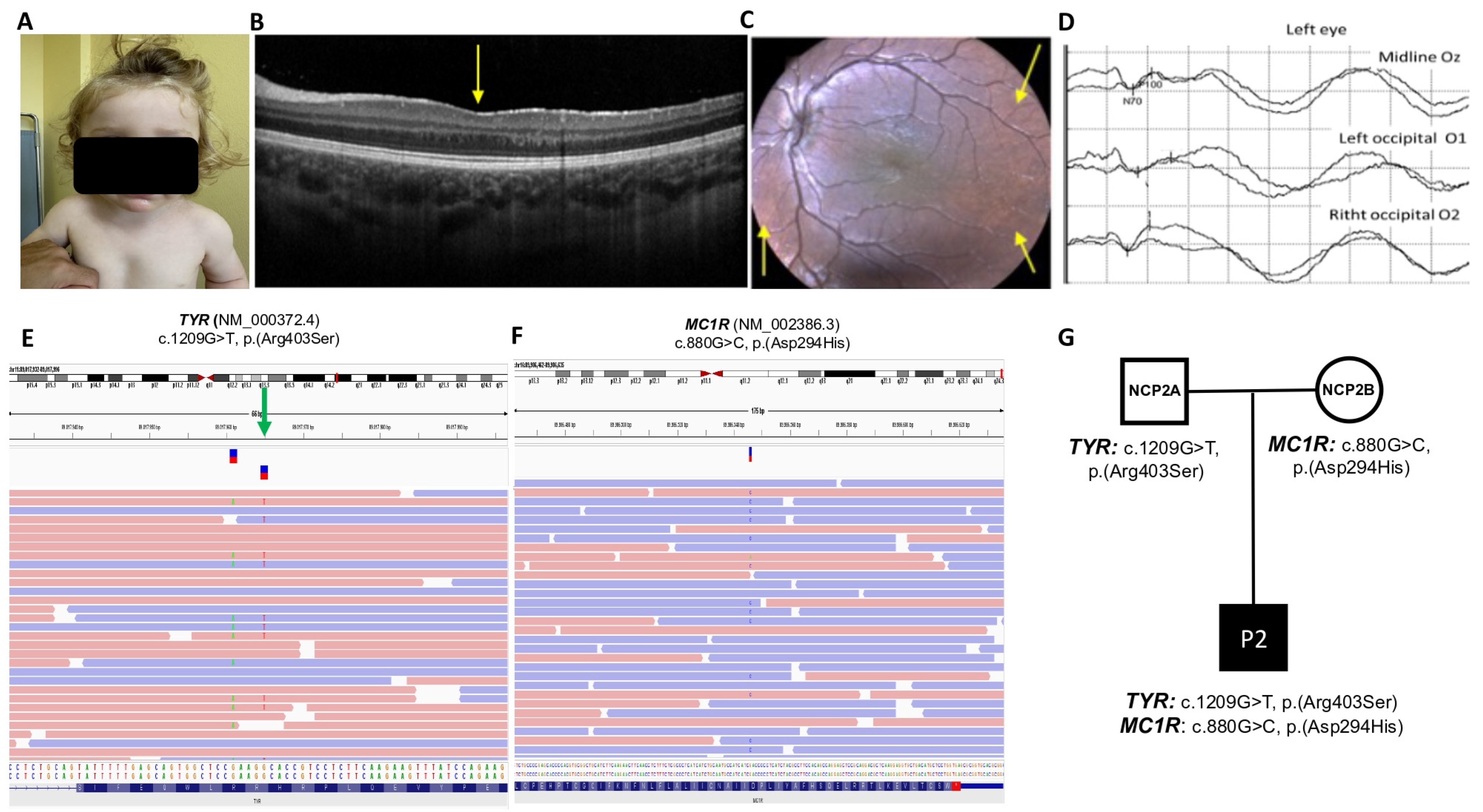 Genes 17 01289 g002 Genes 17 01289 g002