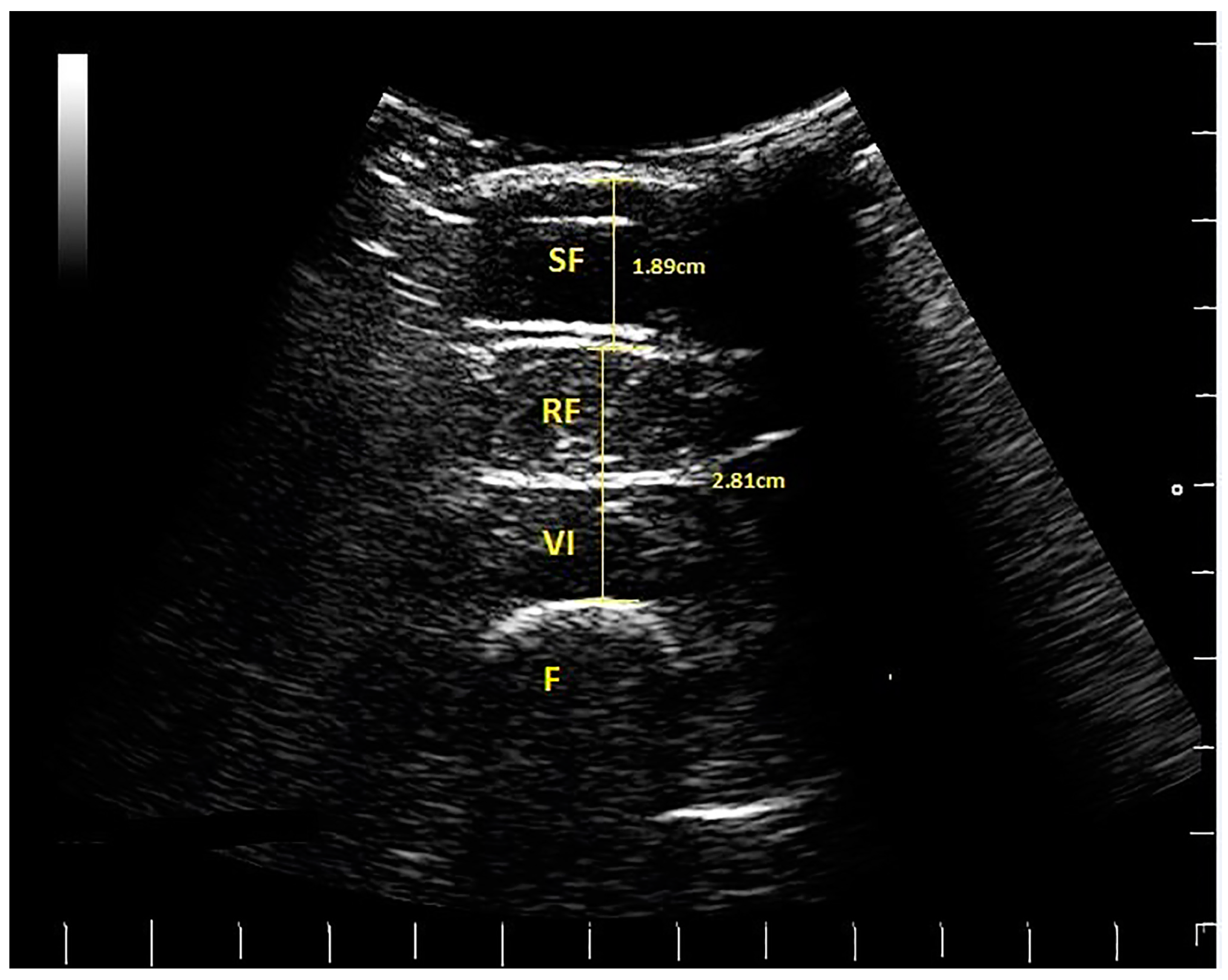Geriatrics 02 00010 g002