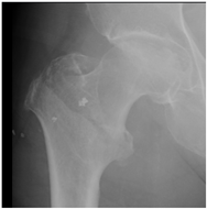 Geriatrics 07 00018 i001