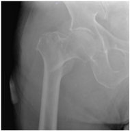 Geriatrics 07 00018 i002