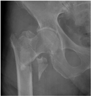 Geriatrics 07 00018 i003