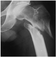 Geriatrics 07 00018 i004