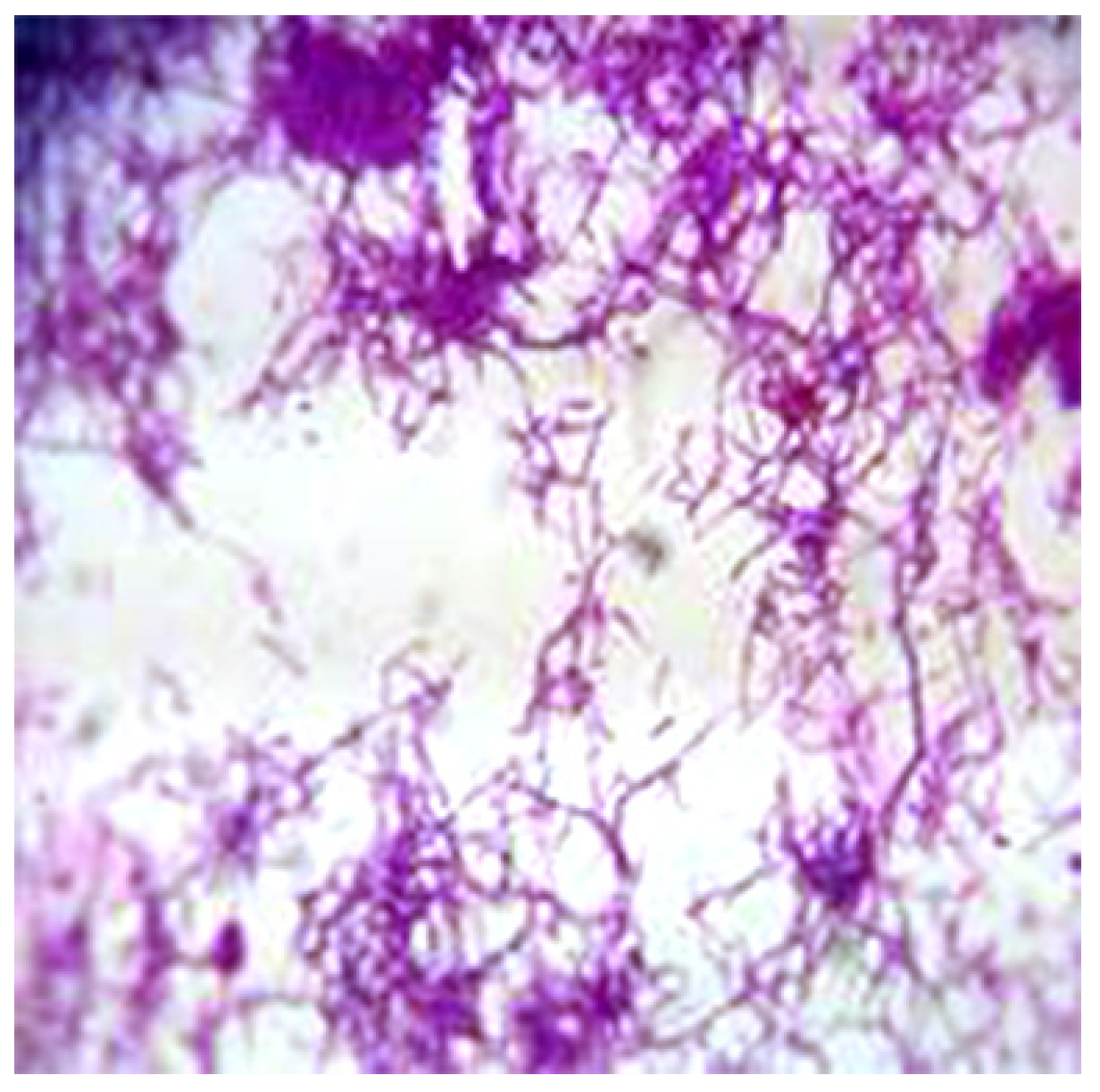 Germs 05 00012 g002 Germs 05 00012 g002