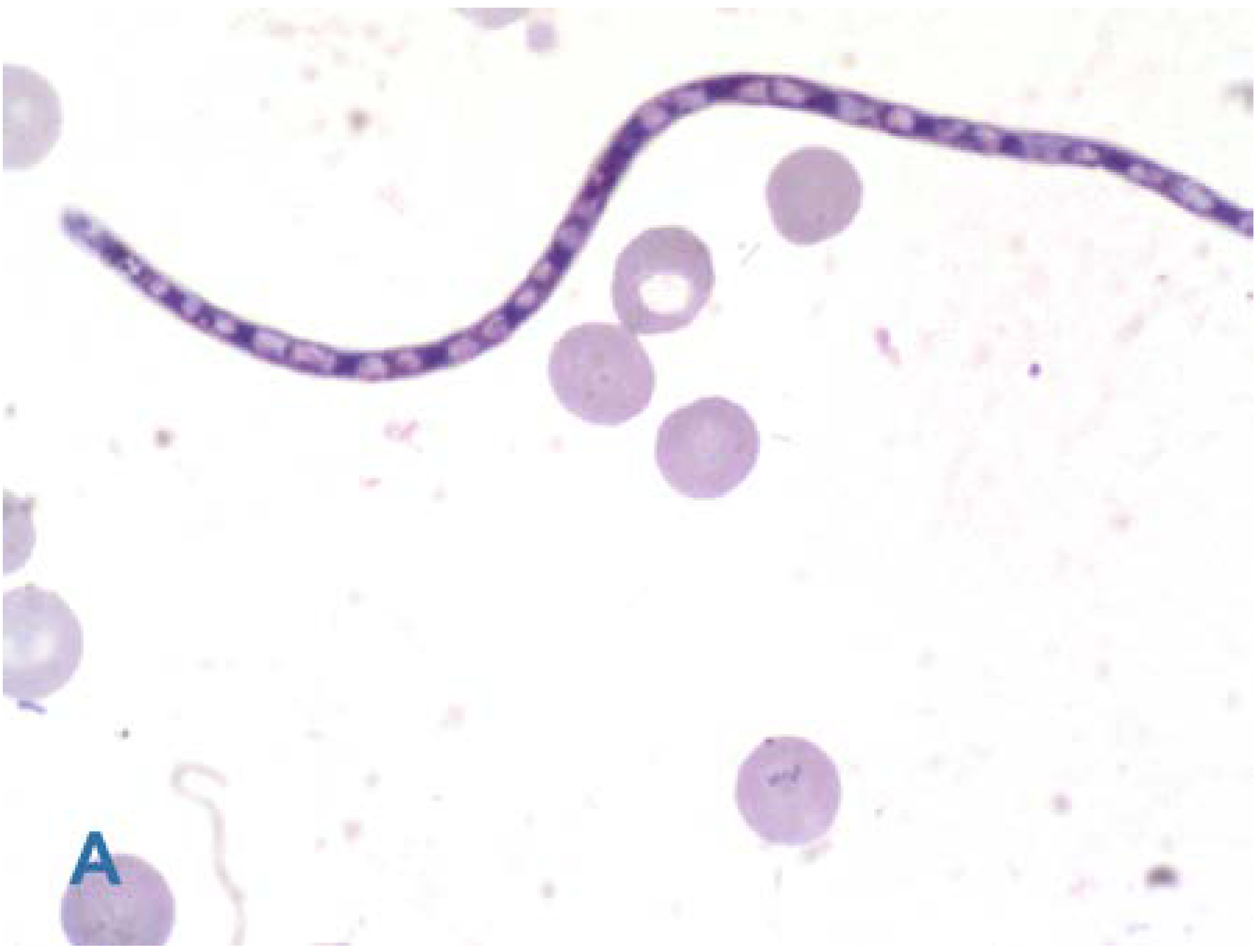 Germs 06 00151 g003a