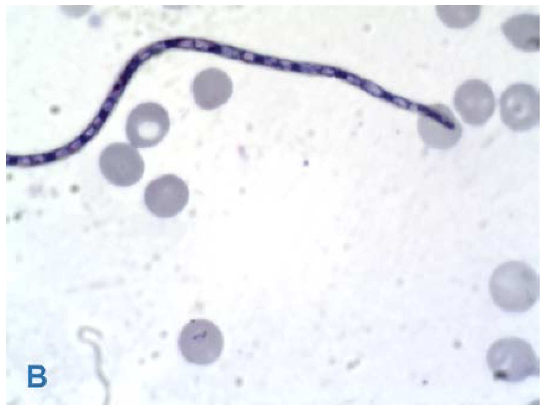 Germs 06 00151 g003b