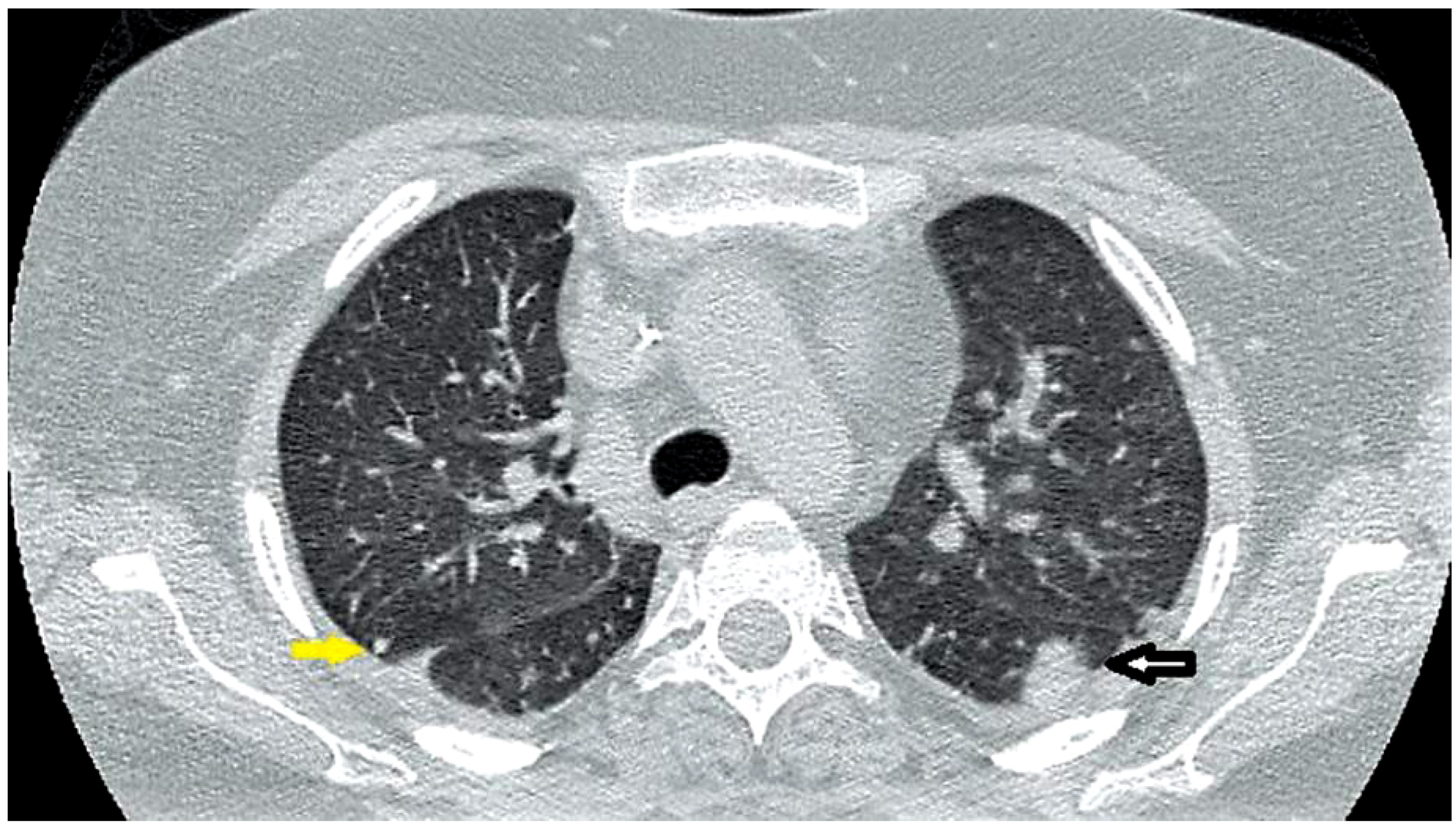 Germs 07 00149 g002 Germs 07 00149 g002