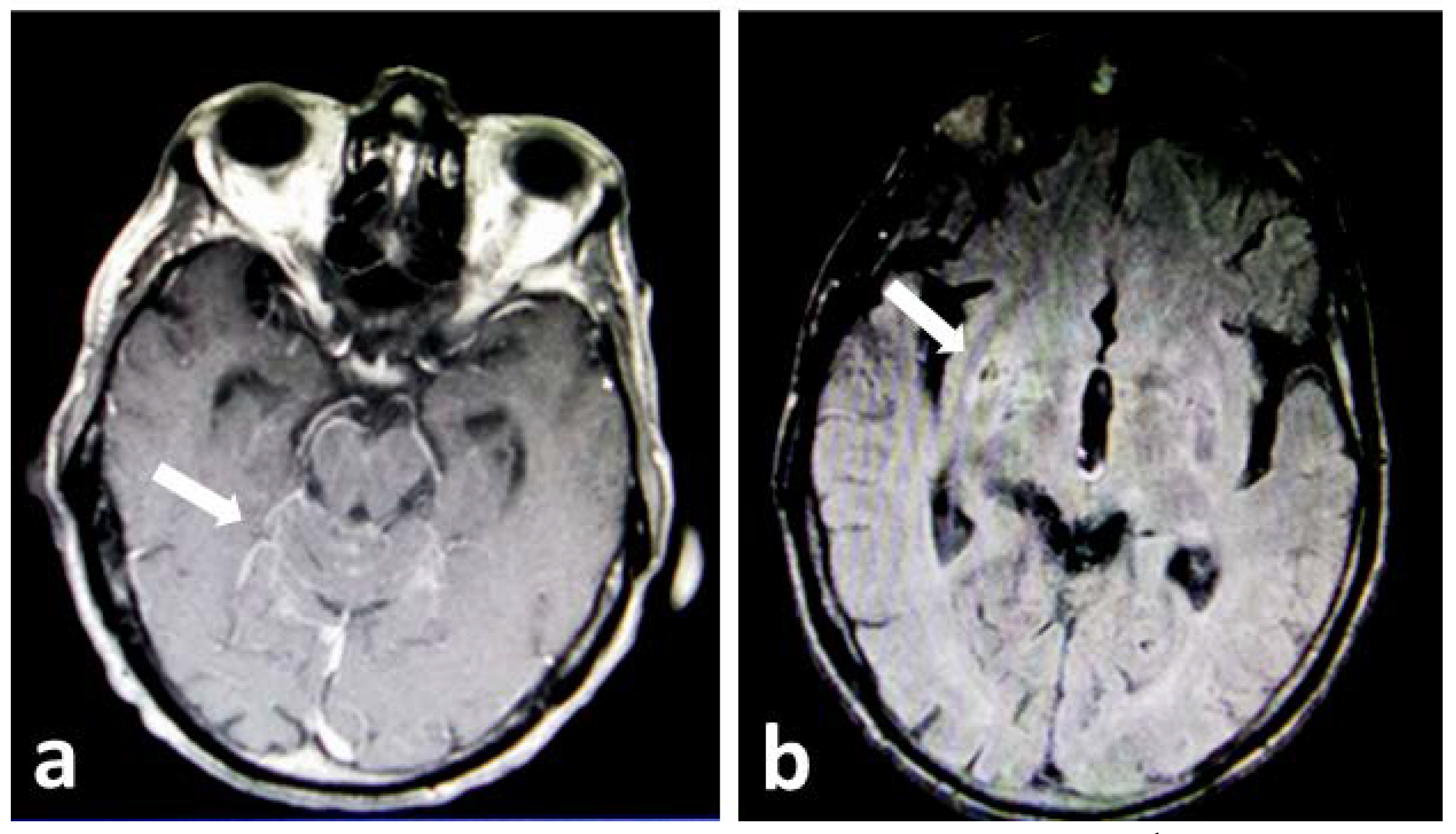 Germs 10 00388 g001 Germs 10 00388 g001