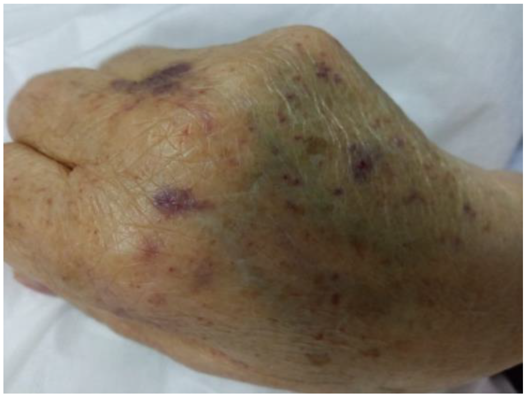 Germs 11 00319 g001 Germs 11 00319 g001