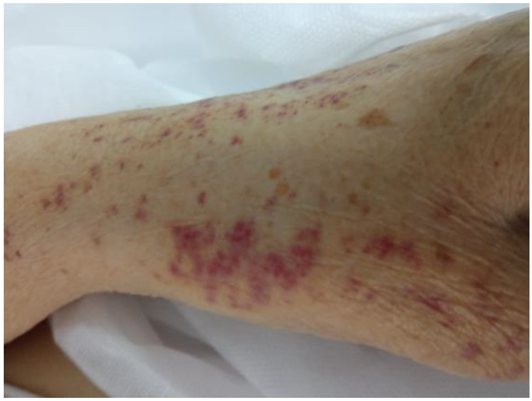 Germs 11 00319 g002 Germs 11 00319 g002