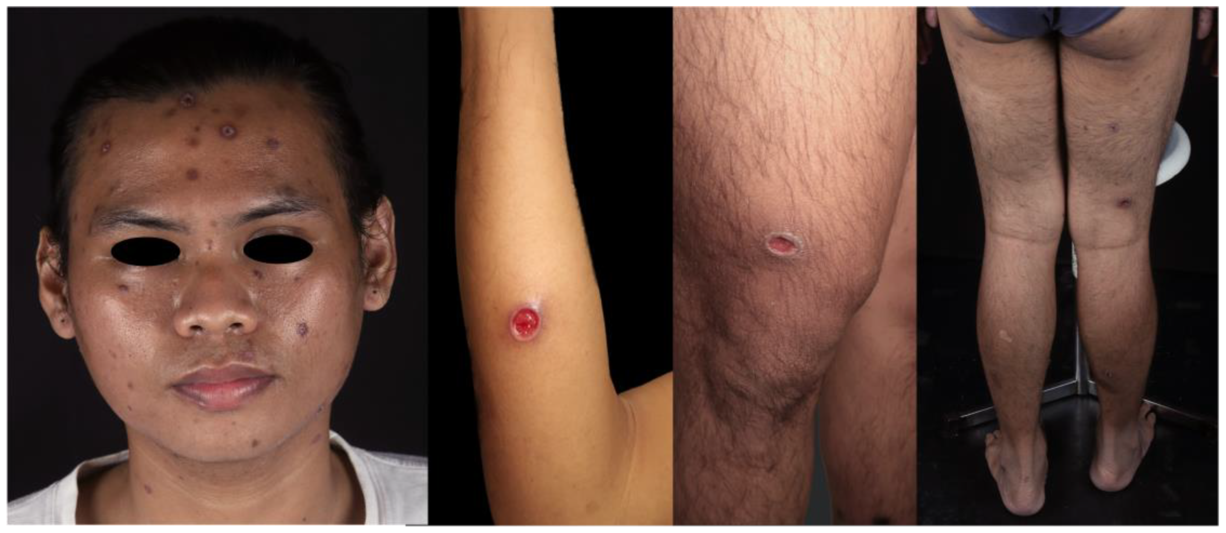 Germs 13 00168 g001 Germs 13 00168 g001