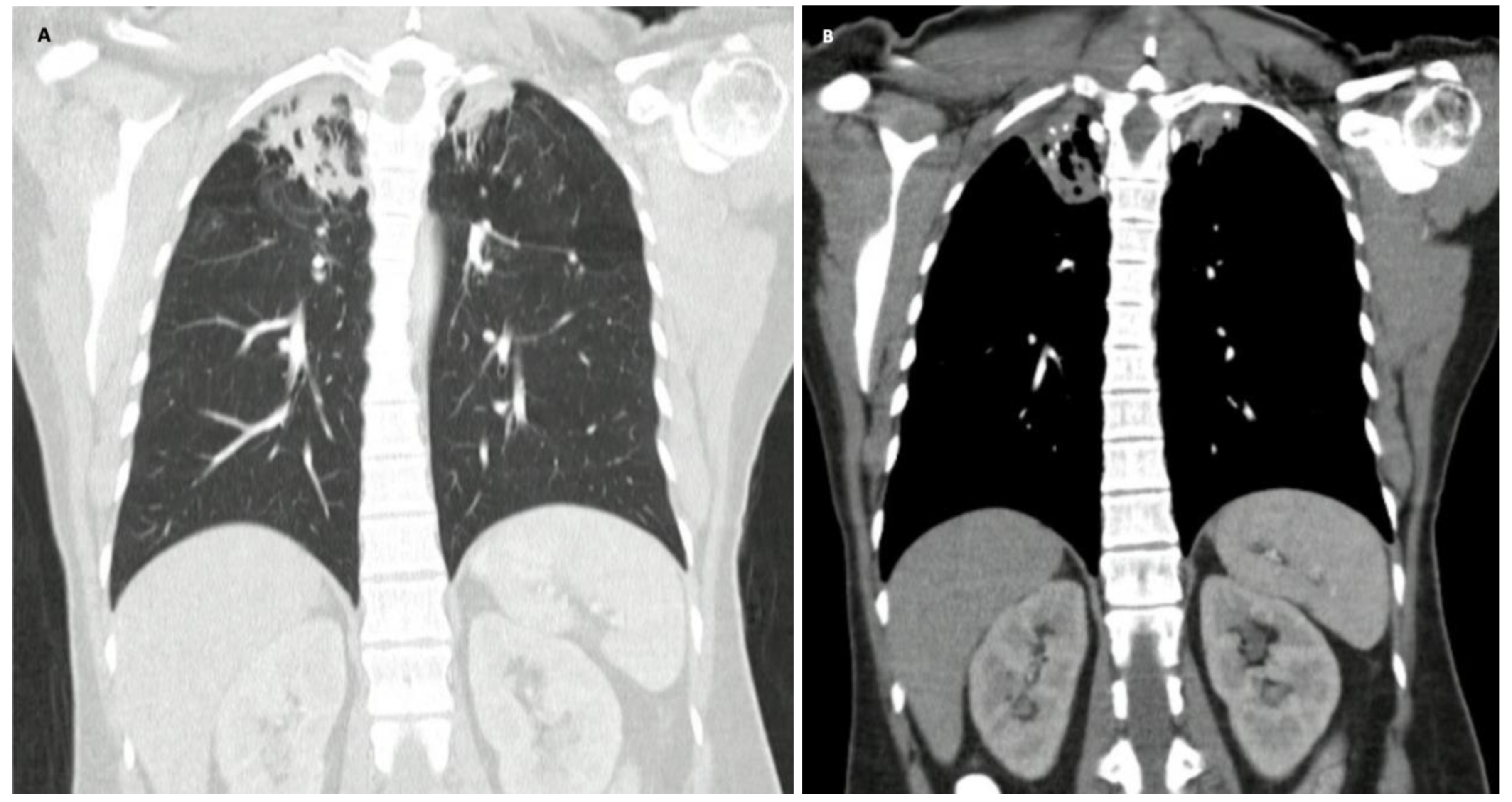 Germs 13 00259 g001 Germs 13 00259 g001