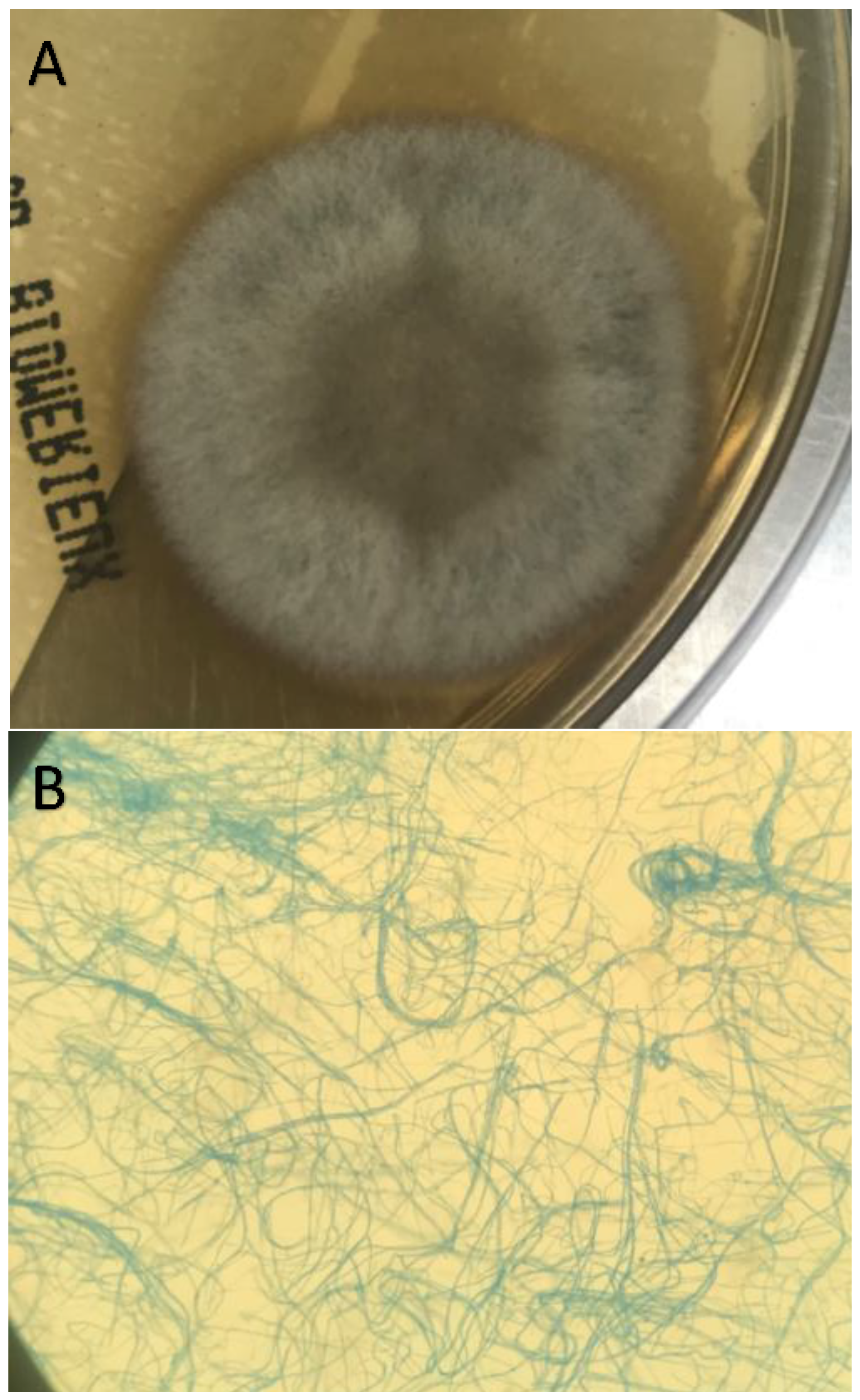 Germs 15 00071 g002 Germs 15 00071 g002