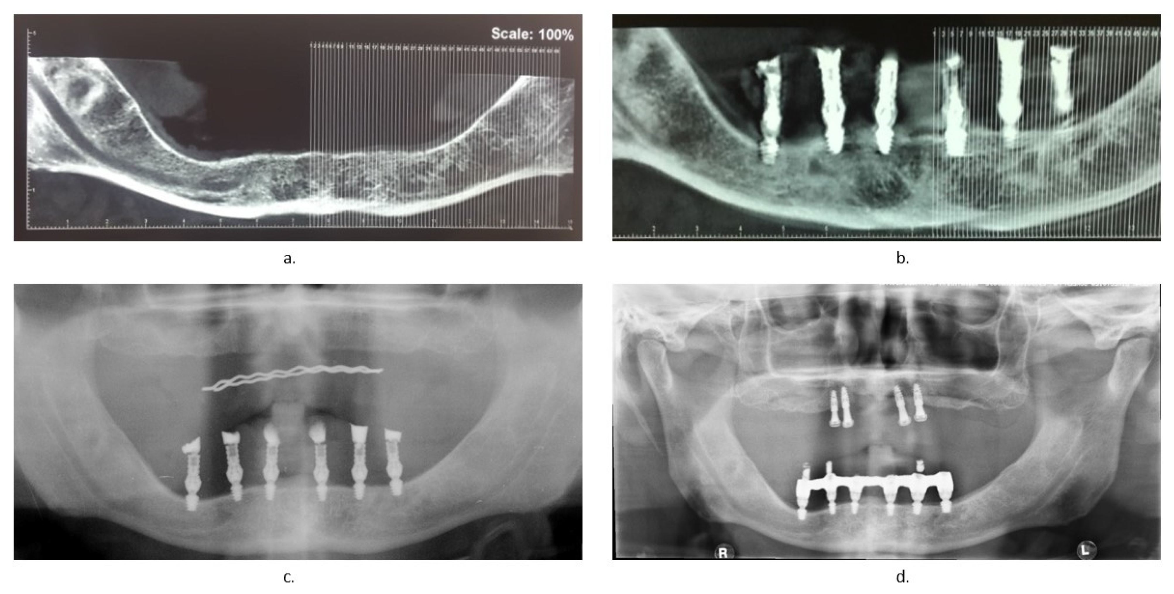 Healthcare 09 00175 g004