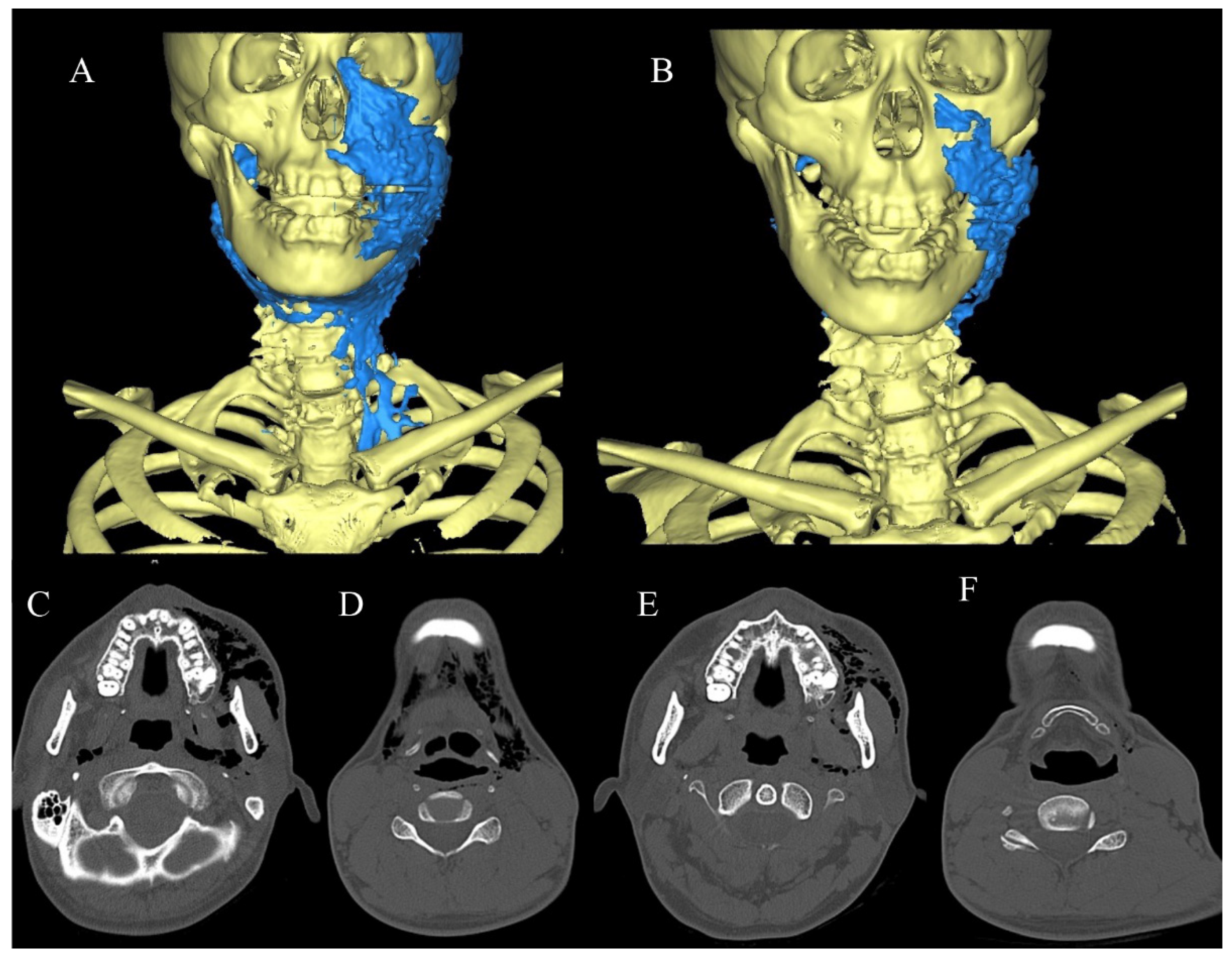 Healthcare 10 00290 g008