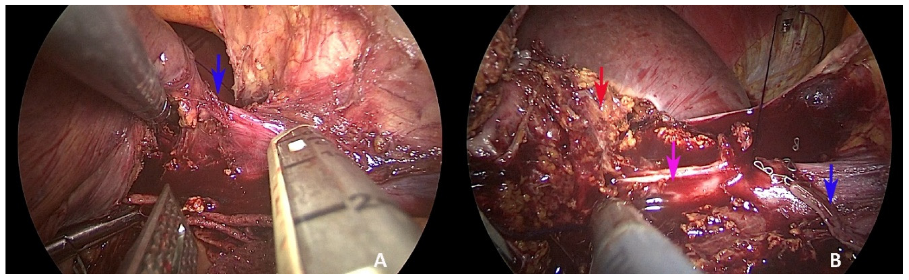 Healthcare 10 00517 g004