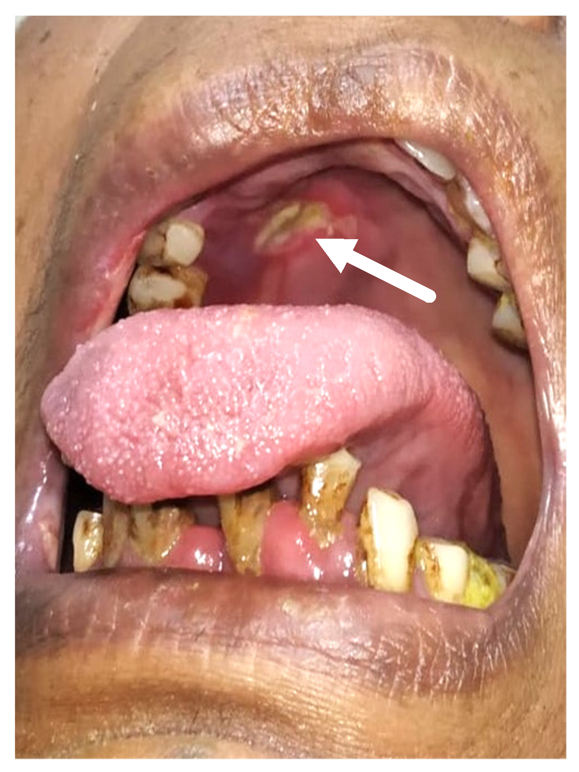 Healthcare 10 00912 g001