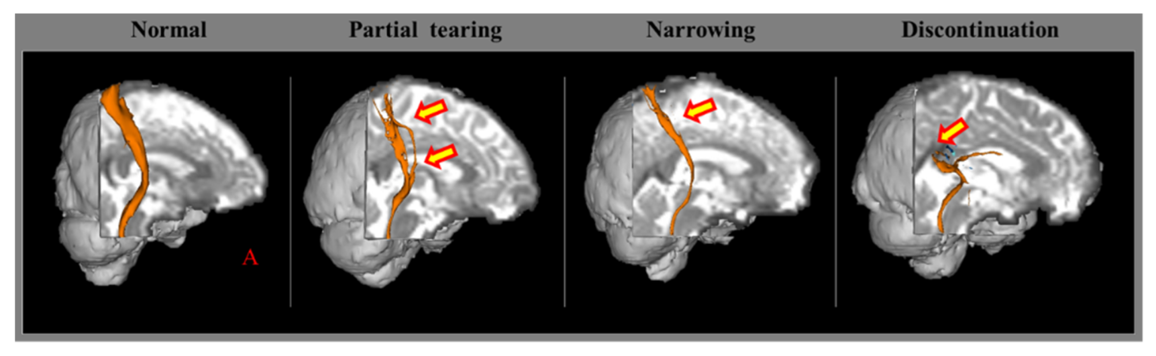 Healthcare 10 00931 g001