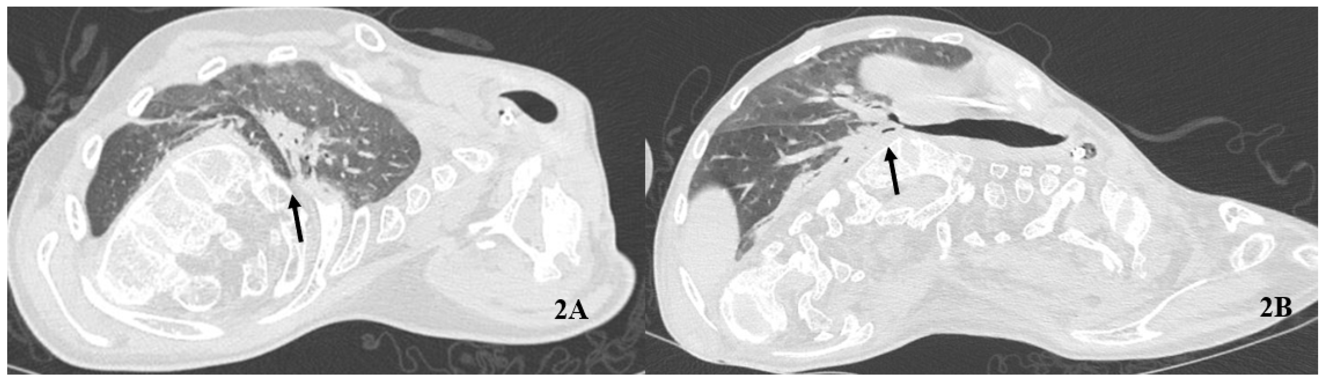 Healthcare 10 01012 g002