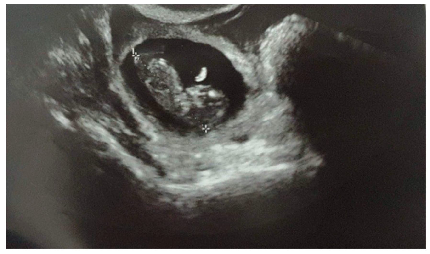 Healthcare 10 01590 g001