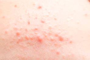 Healthcare 10 02396 i001