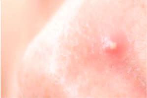 Healthcare 10 02396 i003