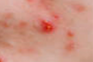 Healthcare 10 02396 i004