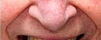 Healthcare 10 02396 i010