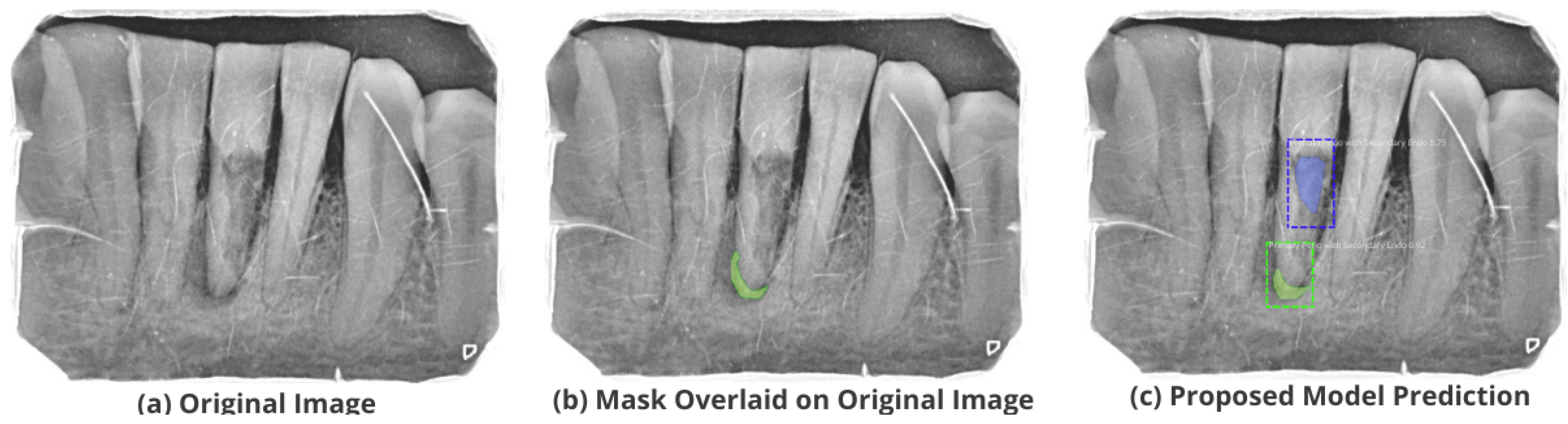 Healthcare 11 00347 g012