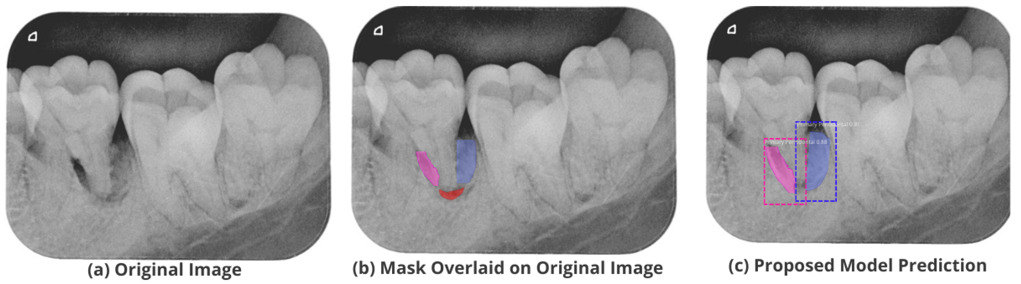 Healthcare 11 00347 g013