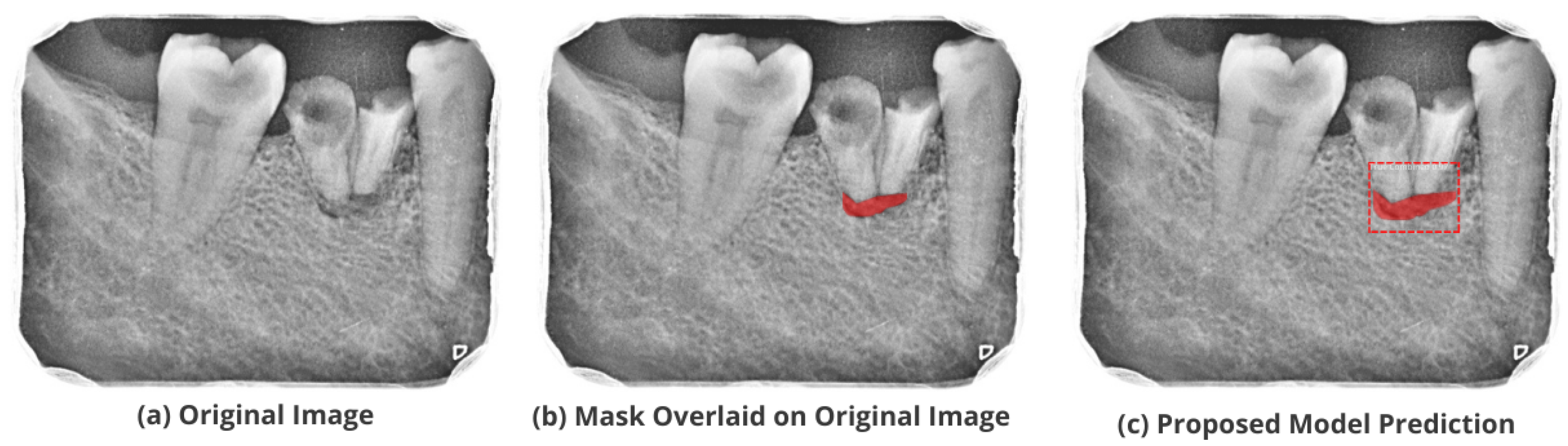 Healthcare 11 00347 g014