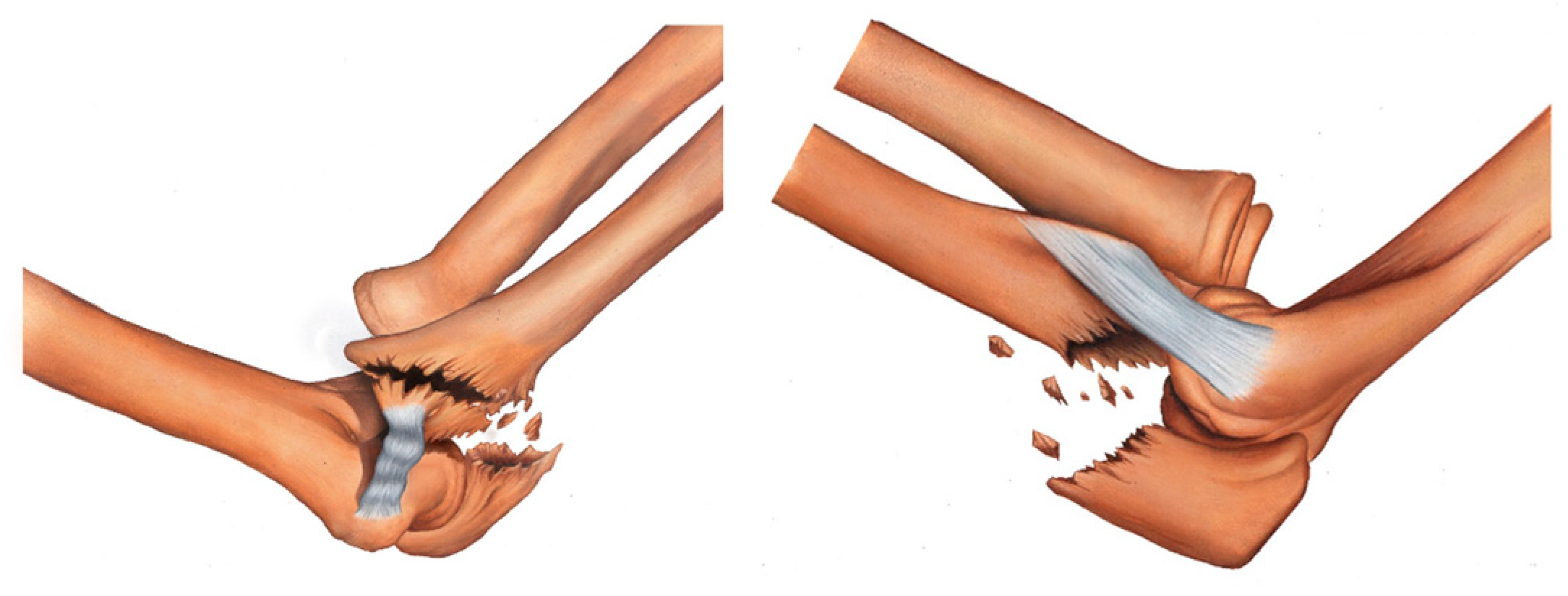 Healthcare 11 00693 g004 Healthcare 11 00693 g004