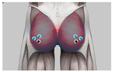 Healthcare 11 00895 i009 Healthcare 11 00895 i009