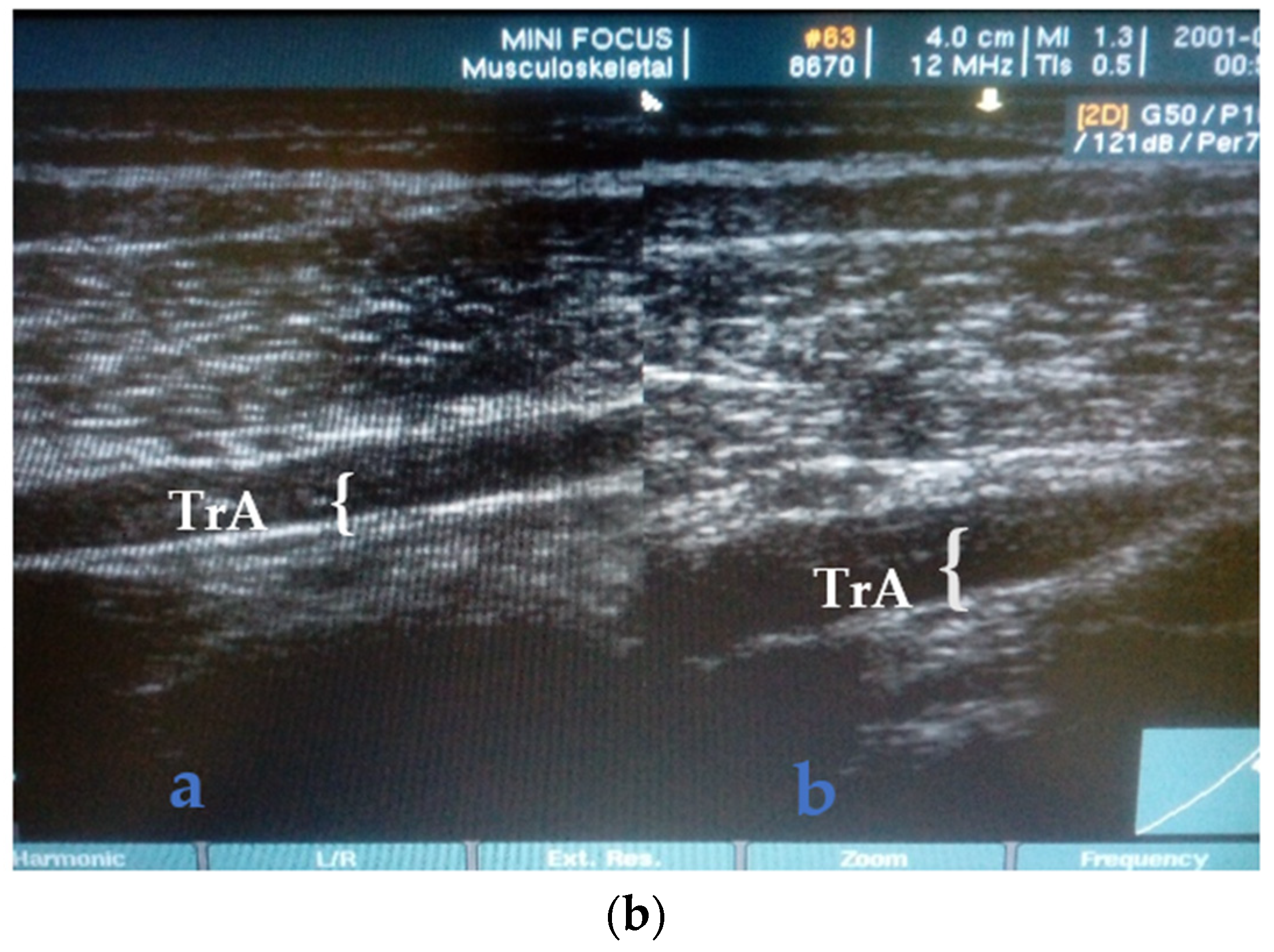 Healthcare 11 01396 g001b