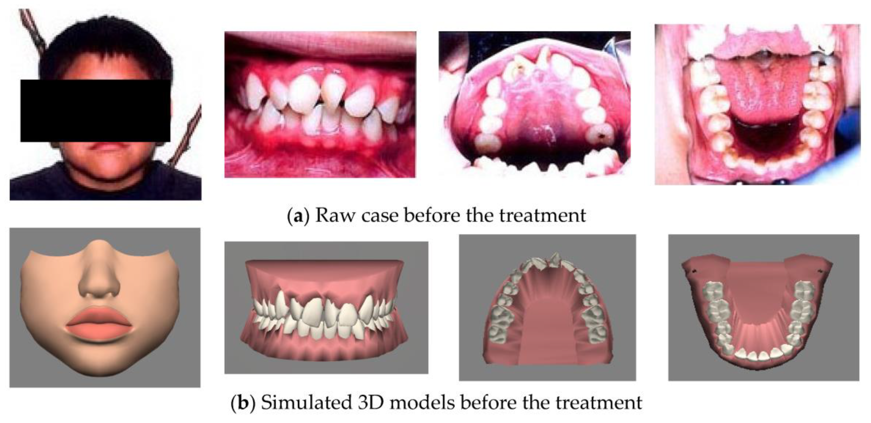 Healthcare 11 01433 g007 Healthcare 11 01433 g007