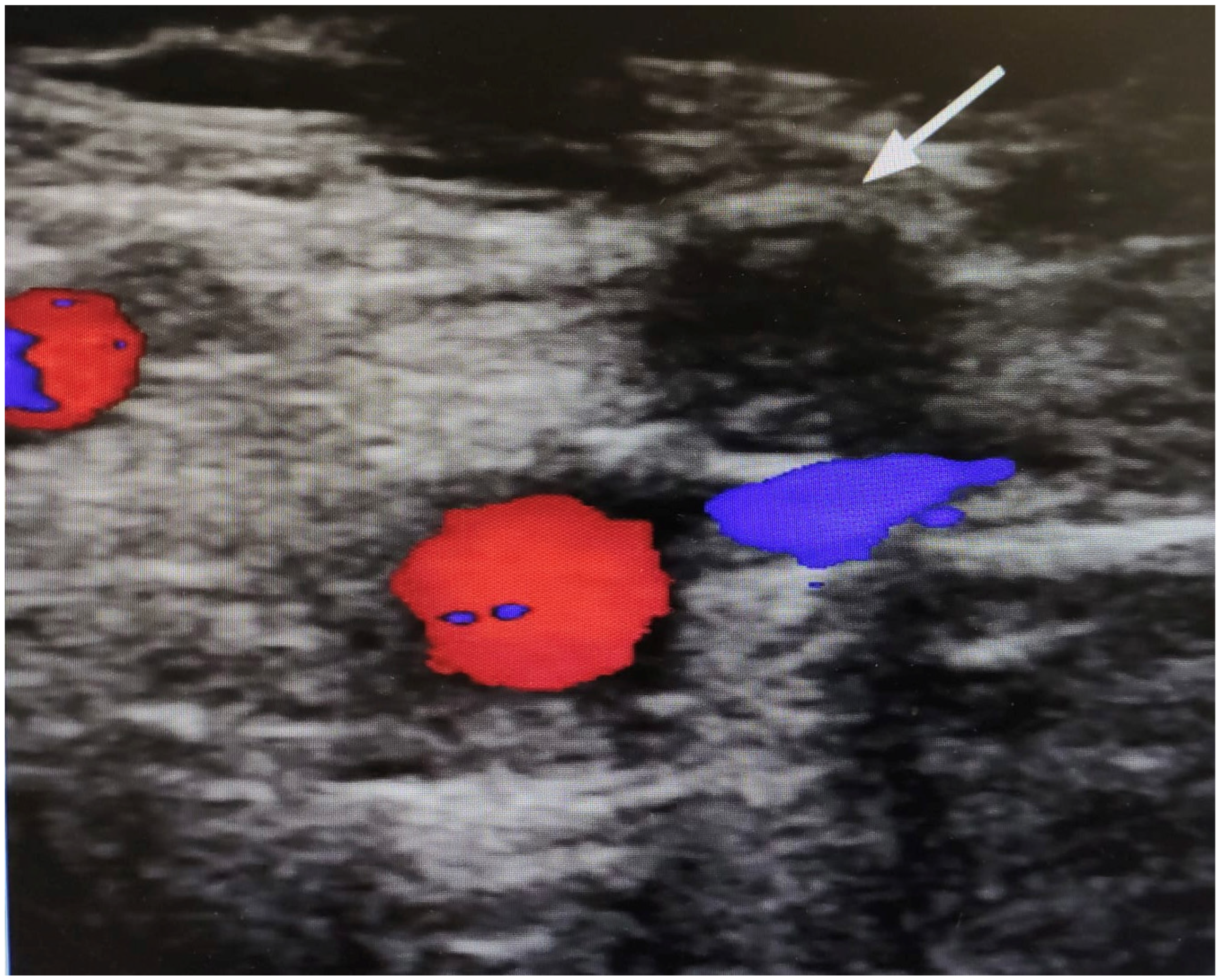 Healthcare 11 01527 g003 Healthcare 11 01527 g003