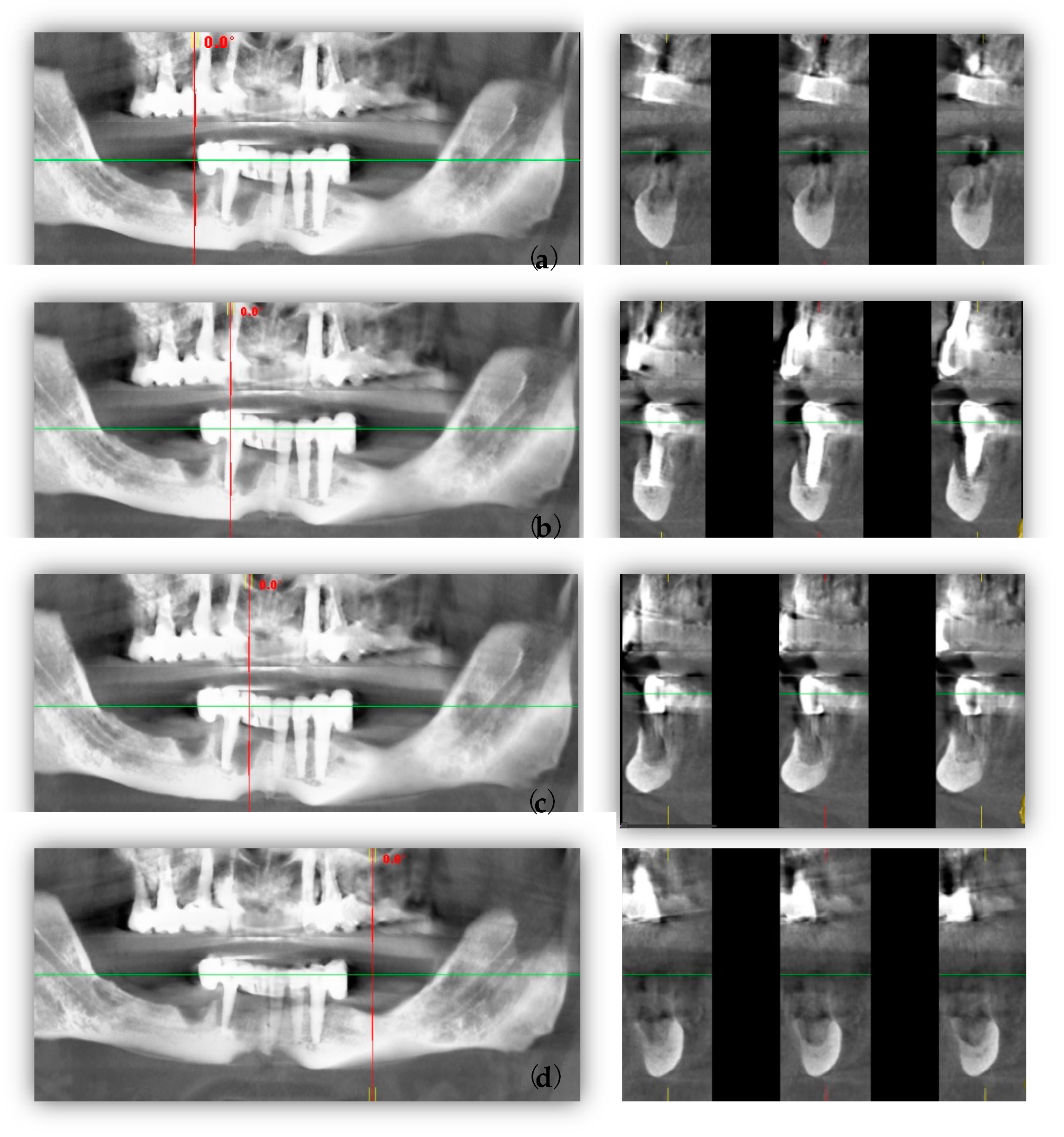 Healthcare 11 01608 g002 Healthcare 11 01608 g002