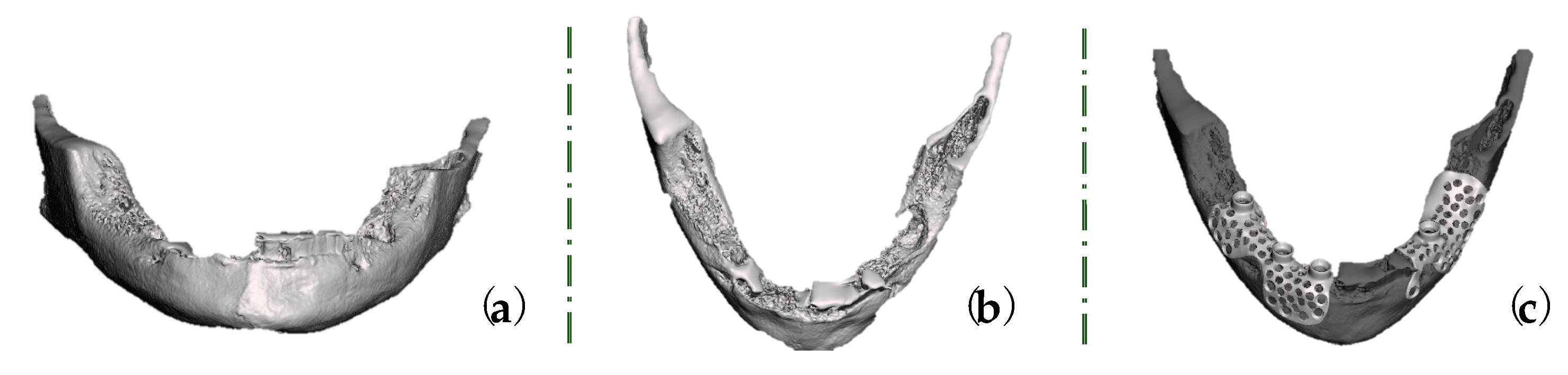 Healthcare 11 01608 g004 Healthcare 11 01608 g004